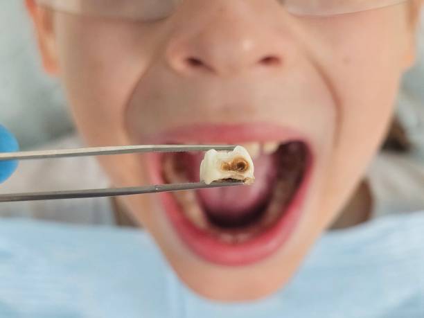 Emergency Dentist for Kids in OH